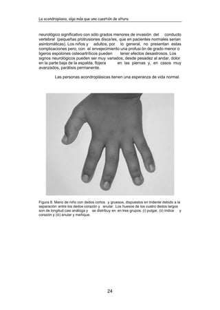 La acondroplasia, algo más que una cuestión de altura.
24
neurológico significativo con sólo grados menores de invasión del conducto
vertebral (pequeñas protrusiones disca les, que en pacientes normales serian
asintomáticas). Los niños y adultos, por lo general, no presentan estas
complicaciones pero, con el envejecimiento una profusi ón de grado menor o
ligeros espolones osteoartríticos pueden tener efectos desastrosos. Los
signos neurológicos pueden ser muy variados, desde pesadez al andar, dolor
en la parte baja de la espalda, flojera en las piernas y, en casos muy
avanzados, parálisis permanente.
Las personas acondroplásicas tienen una esperanza de vida normal.
Figura 8. Mano de niño con dedos cortos y gruesos, dispuestos en tridente debido a la
separación entre los dedos corazón y anular. Los huesos de los cuatro dedos largos
son de longitud casi análoga y se distribuy en en tres grupos: (i) pulgar, (ii) índice y
corazón y (iii) anular y meñique.
 