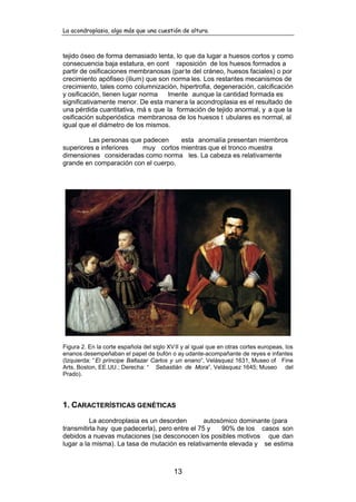 La acondroplasia, algo más que una cuestión de altura.
13
tejido óseo de forma demasiado lenta, lo que da lugar a huesos cortos y como
consecuencia baja estatura, en cont raposición de los huesos formados a
partir de osificaciones membranosas (parte del cráneo, huesos faciales) o por
crecimiento apófiseo (ilium) que son norma les. Los restantes mecanismos de
crecimiento, tales como columnización, hipertrofia, degeneración, calcificación
y osificación, tienen lugar norma lmente aunque la cantidad formada es
significativamente menor. De esta manera la acondroplasia es el resultado de
una pérdida cuantitativa, má s que la formación de tejido anormal, y a que la
osificación subperióstica membranosa de los huesos t ubulares es normal, al
igual que el diámetro de los mismos.
Las personas que padecen esta anomalía presentan miembros
superiores e inferiores muy cortos mientras que el tronco muestra
dimensiones consideradas como norma les. La cabeza es relativamente
grande en comparación con el cuerpo.
Figura 2. En la corte española del siglo XVII y al igual que en otras cortes europeas, los
enanos desempeñaban el papel de bufón o ay udante-acompañante de reyes e infantes
(Izquierda: “El príncipe Baltazar Carlos y un enano”, Velásquez 1631, Museo of Fine
Arts, Boston, EE.UU.; Derecha: “ Sebastián de Mora”, Velásquez 1645; Museo del
Prado).
1. CARACTERÍSTICAS GENÉTICAS
La acondroplasia es un desorden autosómico dominante (para
transmitirla hay que padecerla), pero entre el 75 y 90% de los casos son
debidos a nuevas mutaciones (se desconocen los posibles motivos que dan
lugar a la misma). La tasa de mutación es relativamente elevada y se estima
 
