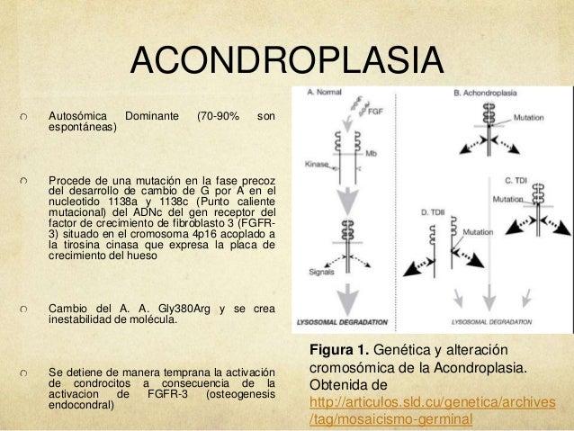 Acondroplasia