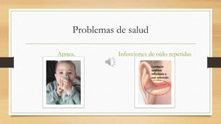 Problemas de salud
Apnea. Infecciones de oído repetidas
 