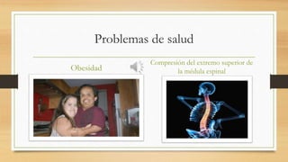 Problemas de salud
Obesidad
Compresión del extremo superior de
la médula espinal
 