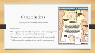 Características
La persona con Acondroplasia suele tener:
*Baja estatura
*Parte superior corta de los brazos y muslos cortos (en comparación
con el antebrazo y la parte inferior de las piernas).
*Cabeza y frente prominentes, con el puente de la nariz achatado.
*Problemas dentales, incluidos dientes torcidos o amontonados.
 