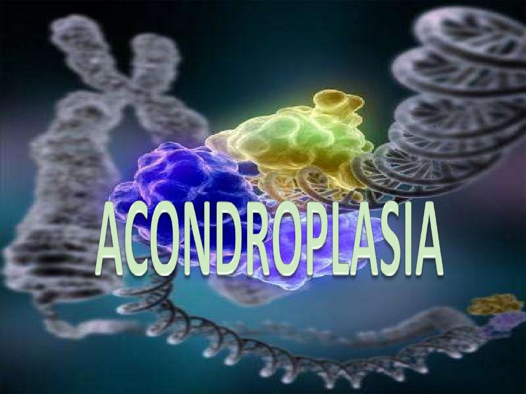 AcondroplasiA