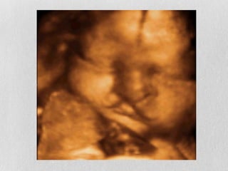 Aconselhamento Genético