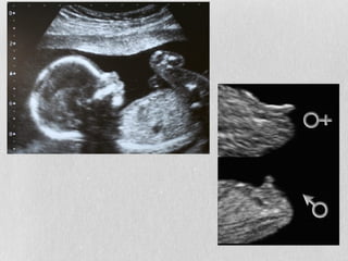 Aconselhamento Genético