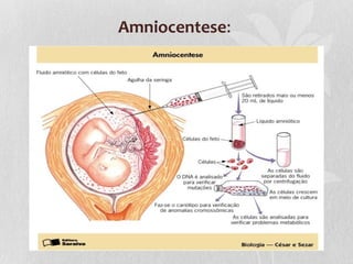 Amniocentese:

 