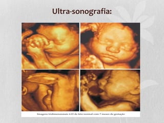 Ultra-sonografia:

 