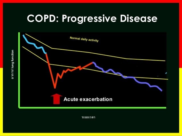 Management of Acute Exacerbztions of COPD at home Management of Acute Exacerbztions of COPD at home