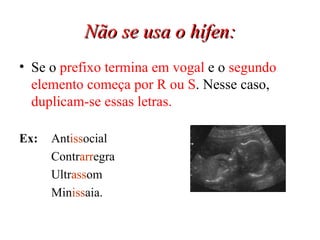 Não se usa o hífen: Se o  prefixo termina em vogal  e o  segundo elemento começa por R ou S . Nesse caso,  duplicam-se essas letras. Ex: Ant iss ocial  Contr arr egra Ultr ass om Min iss aia. 