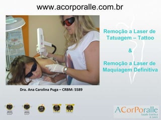Dra. Ana Carolina Puga – CRBM: 5589 www.acorporalle.com.br Remoção a Laser de  Tatuagem – Tattoo & Remoção a Laser de  Maquiagem Definitiva 