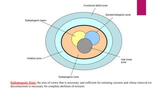 PET/SPECT in Epilepsy Surgery | PPTX