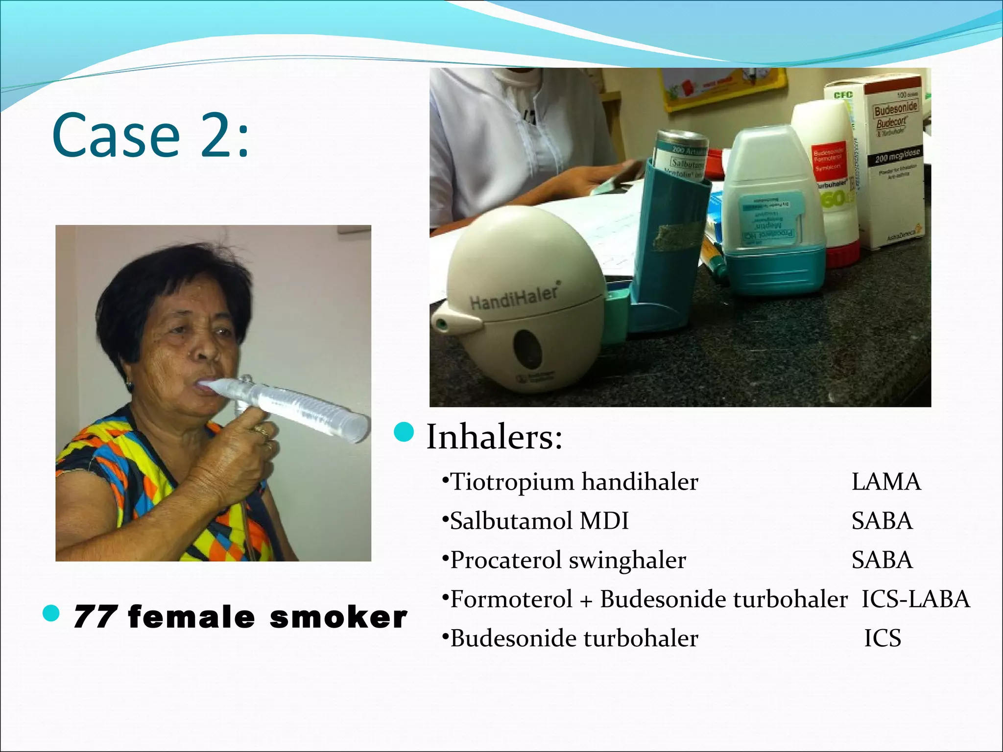 Asthma-COPD Overlap Syndrome - ACOS | PPT