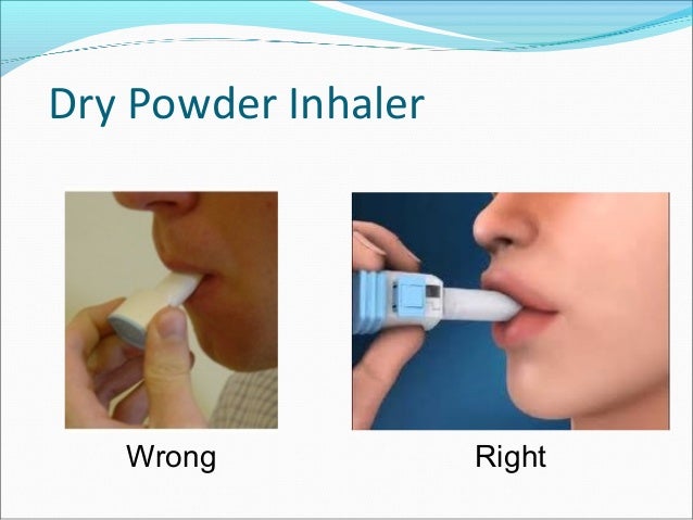 Asthma-COPD Overlap Syndrome - ACOS
