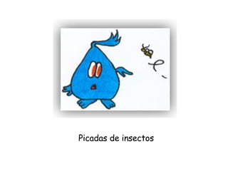 Picadas de insectos 