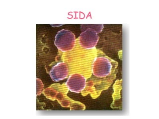 SIDA 