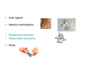 Anel vaginal Adesivo contraceptivo Preservativo feminino   Preservativo masculino   Pílula  