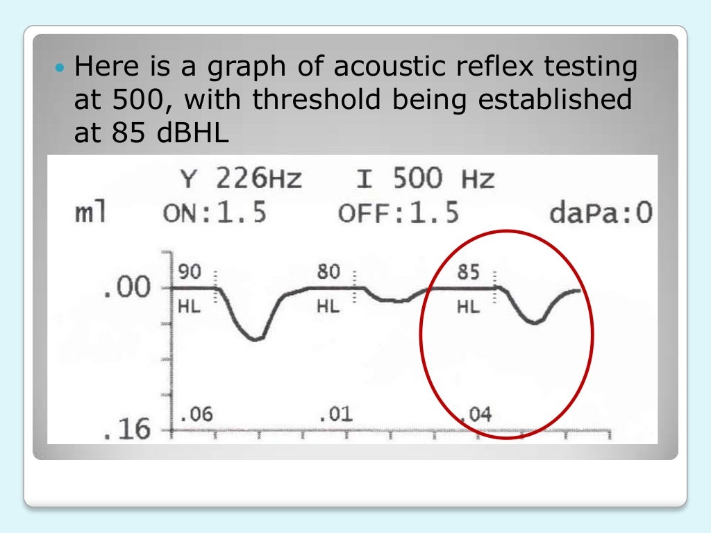 Acoustic Immittance Measurements