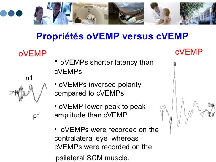 Cvemp Example Cvemp Vs Ovemp _ Effects of age on the tuning of the cVEMP and oVEMP ...