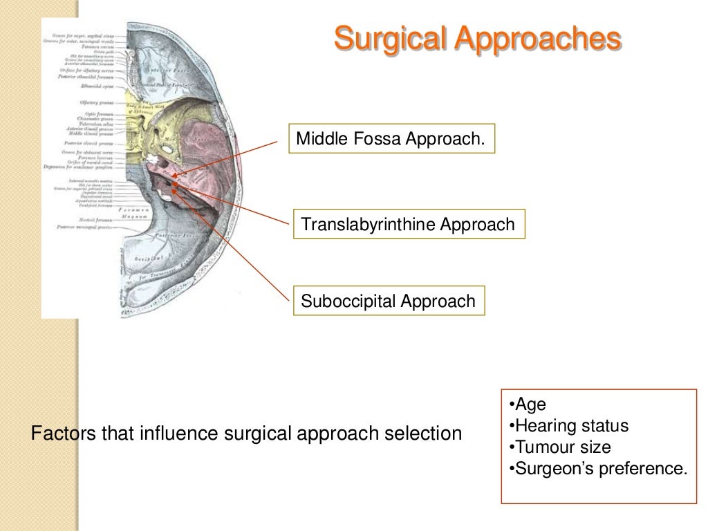 Acoustic neuroma