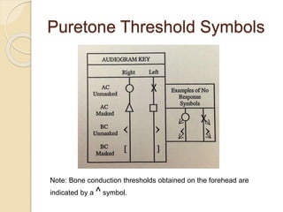 Puretone Threshold Symbols
Note: Bone conduction thresholds obtained on the forehead are
indicated by a ^ symbol.
 
