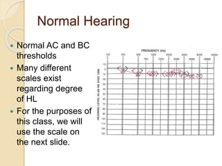 Normal Hearing
 Normal AC and BC
thresholds
 Many different
scales exist
regarding degree
of HL
 For the purposes of
this class, we will
use the scale on
the next slide.
 