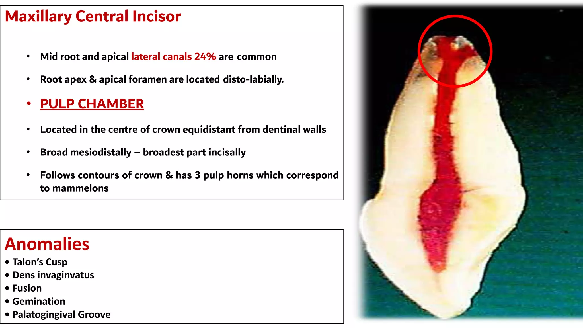 Anomalies
• Talon’s Cusp
• Dens invaginvatus
• Fusion
• Gemination
• Palatogingival Groove
Maxillary Central Incisor
• Mid root and apical lateral canals 24% are common
• Root apex & apical foramen are located disto-labially.
• PULP CHAMBER
• Located in the centre of crown equidistant from dentinal walls
• Broad mesiodistally – broadest part incisally
• Follows contours of crown & has 3 pulp horns which correspond
to mammelons
 