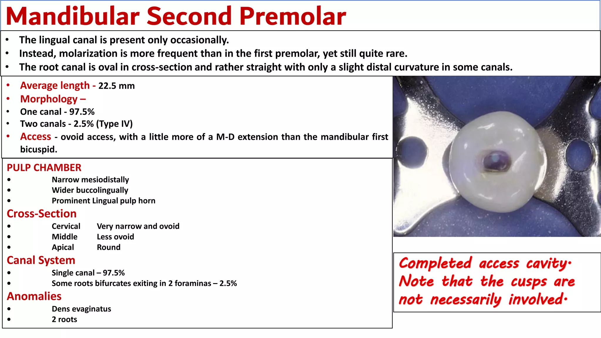 Mandibular Second Premolar
• The lingual canal is present only occasionally.
• Instead, molarization is more frequent than in the first premolar, yet still quite rare.
• The root canal is oval in cross-section and rather straight with only a slight distal curvature in some canals.
• Average length - 22.5 mm
• Morphology –
• One canal - 97.5%
• Two canals - 2.5% (Type IV)
• Access - ovoid access, with a little more of a M-D extension than the mandibular first
bicuspid.
PULP CHAMBER
• Narrow mesiodistally
• Wider buccolingually
• Prominent Lingual pulp horn
Cross-Section
• Cervical Very narrow and ovoid
• Middle Less ovoid
• Apical Round
Canal System
• Single canal – 97.5%
• Some roots bifurcates exiting in 2 foraminas – 2.5%
Anomalies
• Dens evaginatus
• 2 roots
 