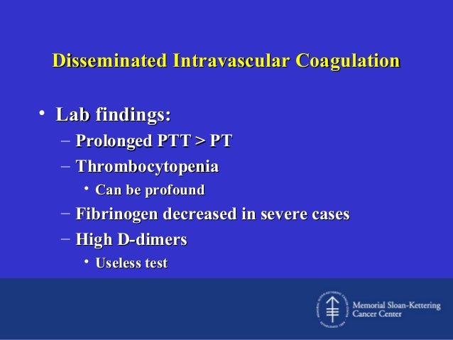 disseminated intravascular coagulation essay disseminated intravascular coagulation essay