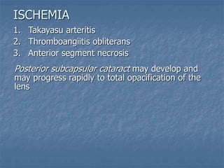1. Takayasu arteritis
2. Thromboangiitis obliterans
3. Anterior segment necrosis
Posterior subcapsular cataract may develop and
may progress rapidly to total opacification of the
lens
ISCHEMIA
 