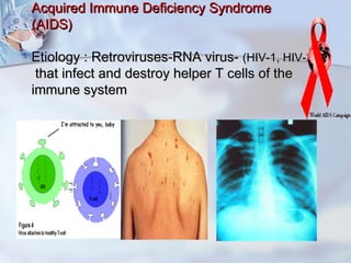 Acquired Immune Deficiency SyndromeAcquired Immune Deficiency Syndrome
(AIDS)(AIDS)
Etiology : Retroviruses-RNA virus-Etiology : Retroviruses-RNA virus- (HIV-1, HIV-2(HIV-1, HIV-2
that infect and destroy helper T cells of thethat infect and destroy helper T cells of the
immune systemimmune system
 