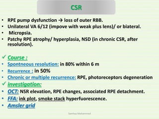 Ama Rpr Reverse Cascade Acquired macular diseases | PPTX