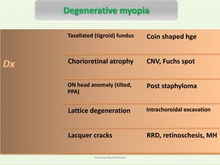 Acquired macular diseases | PPTX