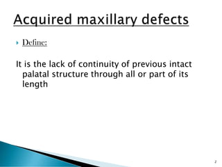 Acquired maxillary defects copy removeable | PDF