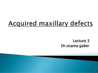 Lecture 3
Dr.osama gaber
1
 