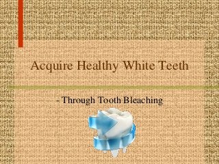 Acquire Healthy White Teeth
- Through Tooth Bleaching
 