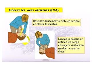 Libérez les voies aériennes (LVA)


                Basculez doucement la tête en arrière
                et élevez le menton




                                   Ouvrez la bouche et
                                   retirez les corps
                                   étrangers visibles en
                                   gardant le menton
                                   élevé
 