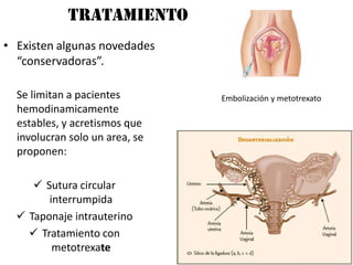 Tratamiento
                                                     ¿?
• Existen algunas novedades
  “conservadoras”.

  Se limitan a pacientes        Embolización y metotrexato
  hemodinamicamente
  estables, y acretismos que
  involucran solo un area, se
  proponen:

      Sutura circular
        interrumpida
   Taponaje intrauterino
     Tratamiento con
         metotrexate
 