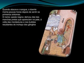 Quando atacava o sangue, o doente
morria poucas horas depois de sentir os
primeiros sintomas.
O nome «peste negra» derivou das tais
manchas pretas que apareciam na pele, à
volta das mordeduras e nos bubões
resultantes do inchaço dos gânglios
 