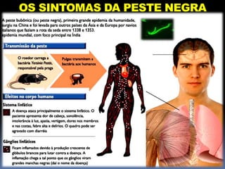 OS SINTOMAS DA PESTE NEGRA
 