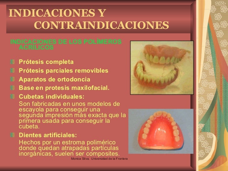 AcríLicos dentales AcríLicos dentales