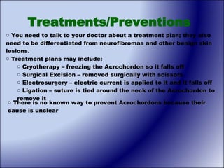 Treatments/Preventions You need to talk to your doctor about a treatment plan; they also need to be differentiated from neurofibromas and other benign skin lesions. Treatment plans may include:  Cryotherapy – freezing the Acrochordon so it falls off Surgical Excision – removed surgically with scissors Electrosurgery – electric current is applied to it and it falls off Ligation – suture is tied around the neck of the Acrochordon to remove it There is no known way to prevent Acrochordons because their cause is unclear 