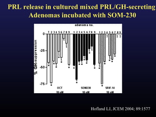 PRL release in cultured mixed PRL/GH-secreting
      Adenomas incubated with SOM-230




                         Hofland LJ, JCEM 2004; 89:1577
 