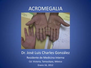 ACROMEGALIA




Dr. José Luis Charles González
   Residente de Medicina Interna
    Cd. Victoria, Tamaulipas, México
             Enero 16, 2012
 