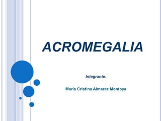 ACROMEGALIA 
Integrante: 
María Cristina Almaraz Montoya 
 