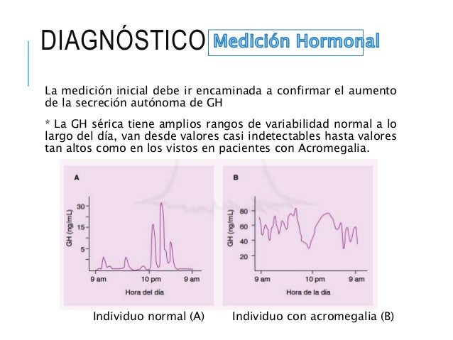 Test Sobrecarga Oral Glucosa Acromegalia - Chungcuso3luongyen Test Sobrecarga Oral Glucosa Acromegalia - Chungcuso3luongyen