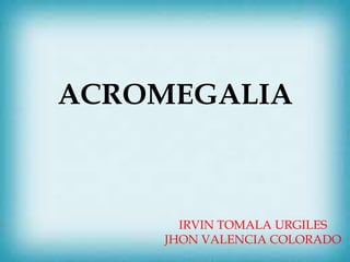 ACROMEGALIA
IRVIN TOMALA URGILES
JHON VALENCIA COLORADO
 