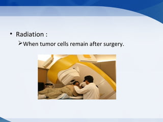 • Radiation :
When tumor cells remain after surgery.
 
