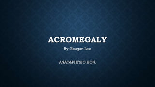 ACROMEGALY
By: Reagan Lee
ANAT&PHYSIO HON.
 