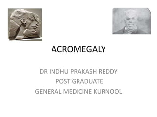 ACROMEGALY
DR INDHU PRAKASH REDDY
POST GRADUATE
GENERAL MEDICINE KURNOOL
 