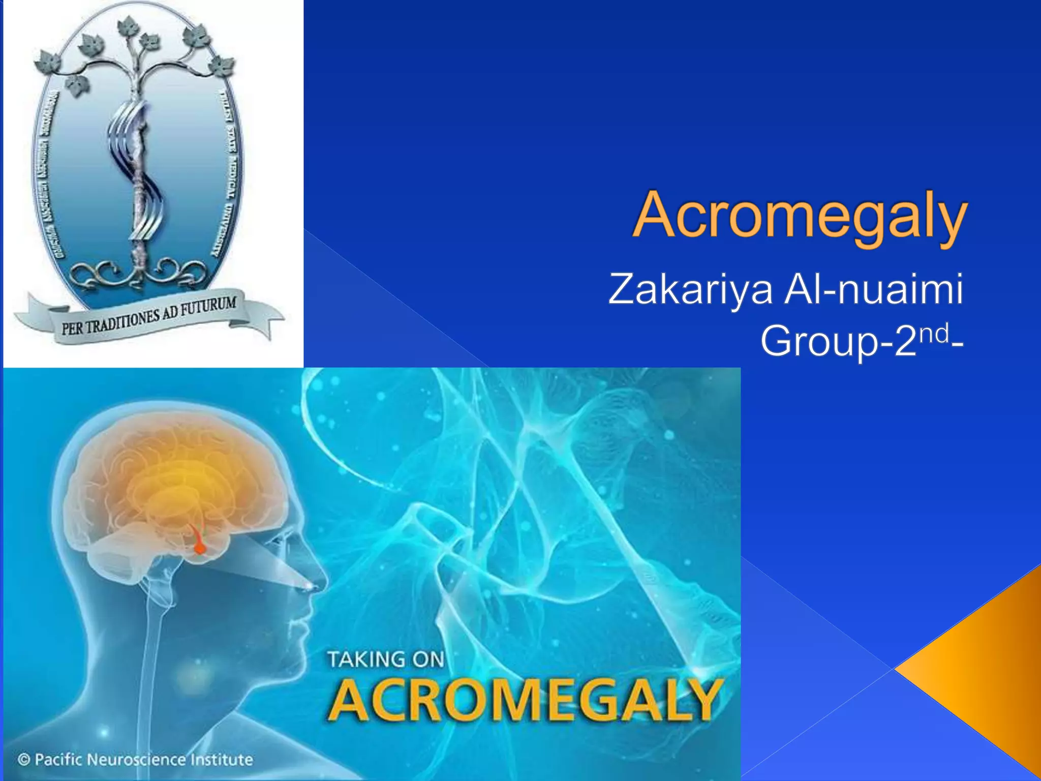 Acromegaly | PPTX